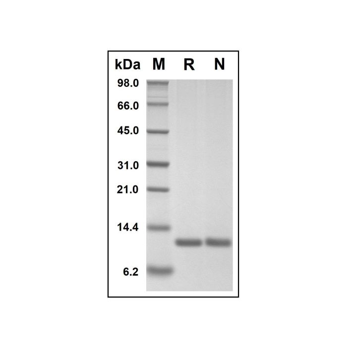 Recombinant Human MIF Protein -    by Aladdin Scientific
