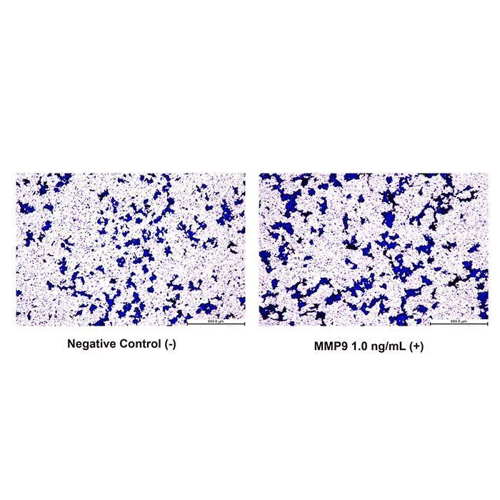 Recombinant Human MMP9 Protein -    by Aladdin Scientific