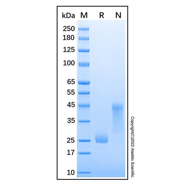 Recombinant Human DAN Protein -    by Aladdin Scientific