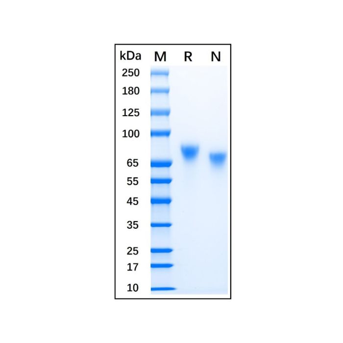 Recombinant Human Nectin-3 Protein -    by Aladdin Scientific