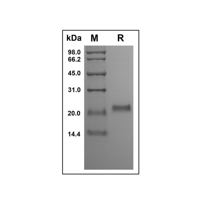 Recombinant Human Osteoprotegerin Protein -    by Aladdin Scientific