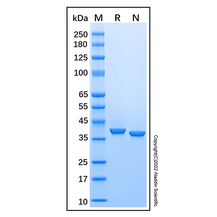Recombinant Human Pepsinogen C/PGC Protein -    by Aladdin Scientific