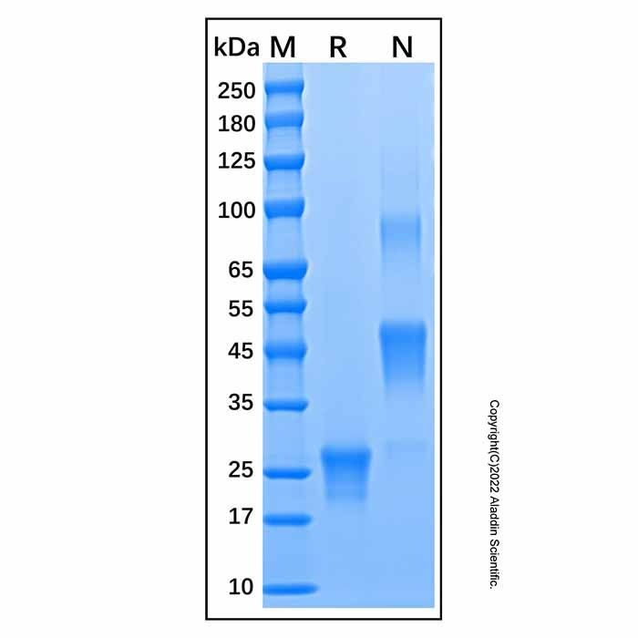 Recombinant Human PlGF Protein -    by Aladdin Scientific