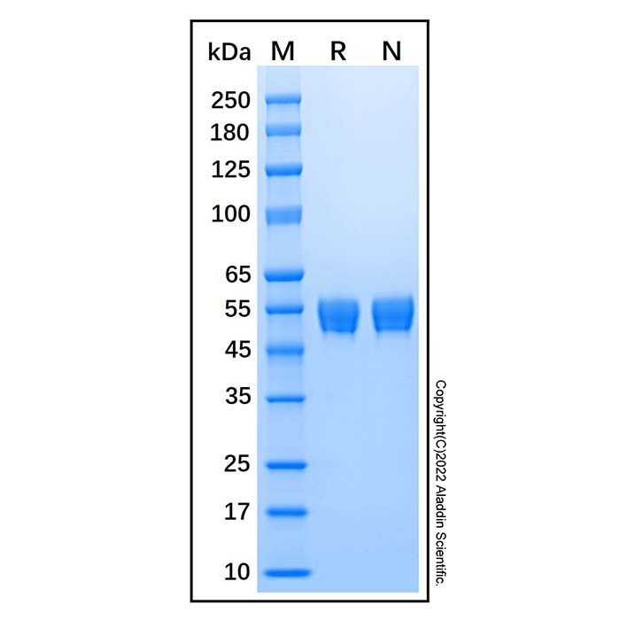 Recombinant Human Serpin A5 Protein -    by Aladdin Scientific