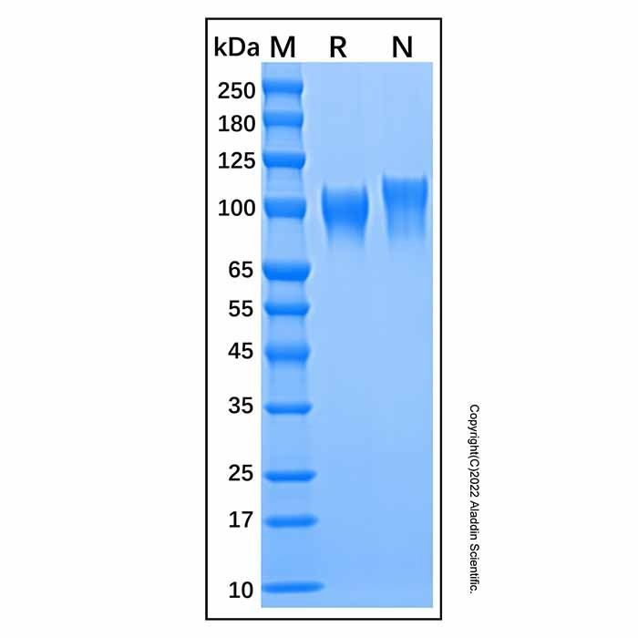 Recombinant Human Serpin G1 Protein -    by Aladdin Scientific