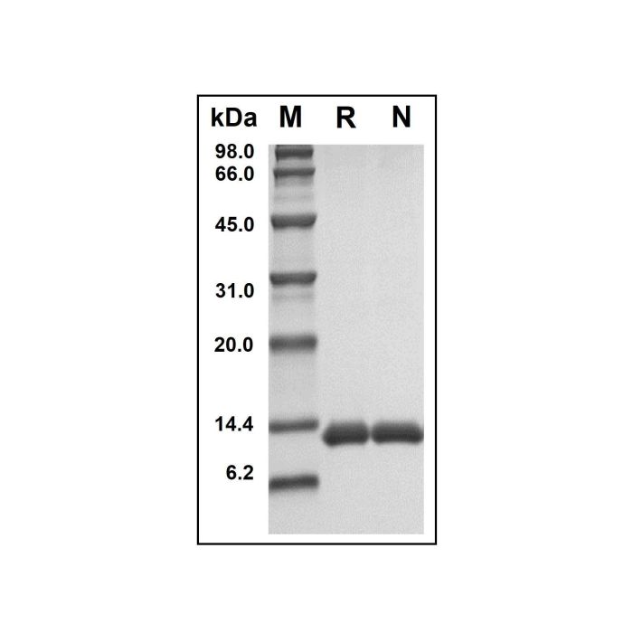 Recombinant Human Serum Amyloid A Protein -    by Aladdin Scientific