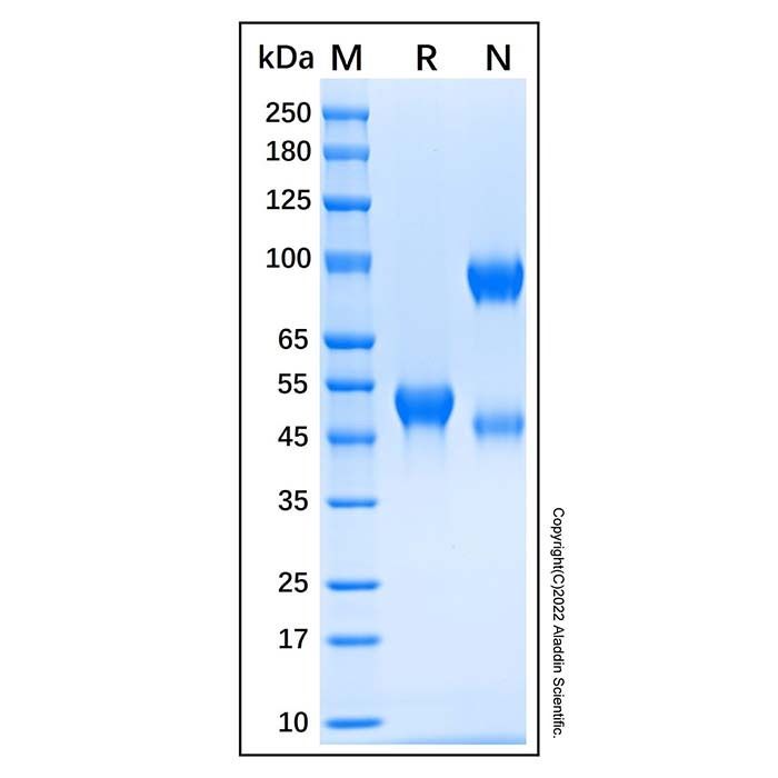 Recombinant Human Siglec-8 Protein -    by Aladdin Scientific