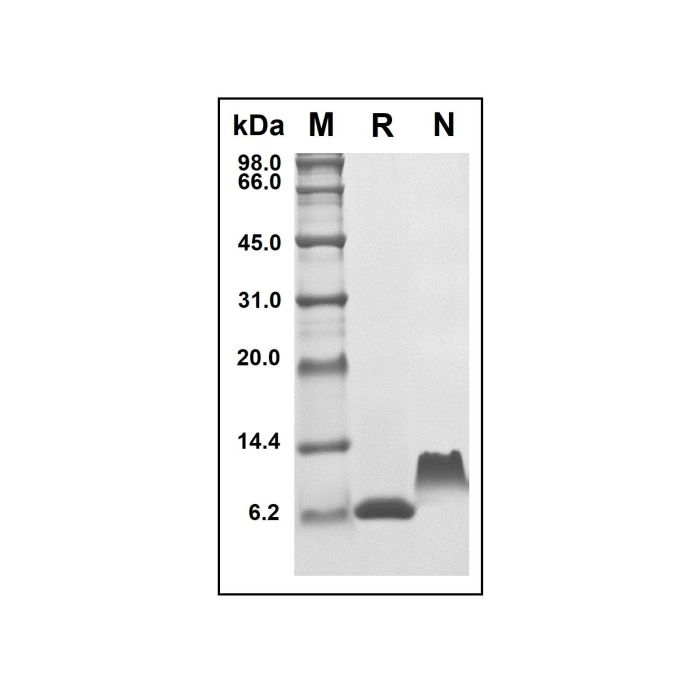 Recombinant Human TARC/CCL17 Protein -    by Aladdin Scientific