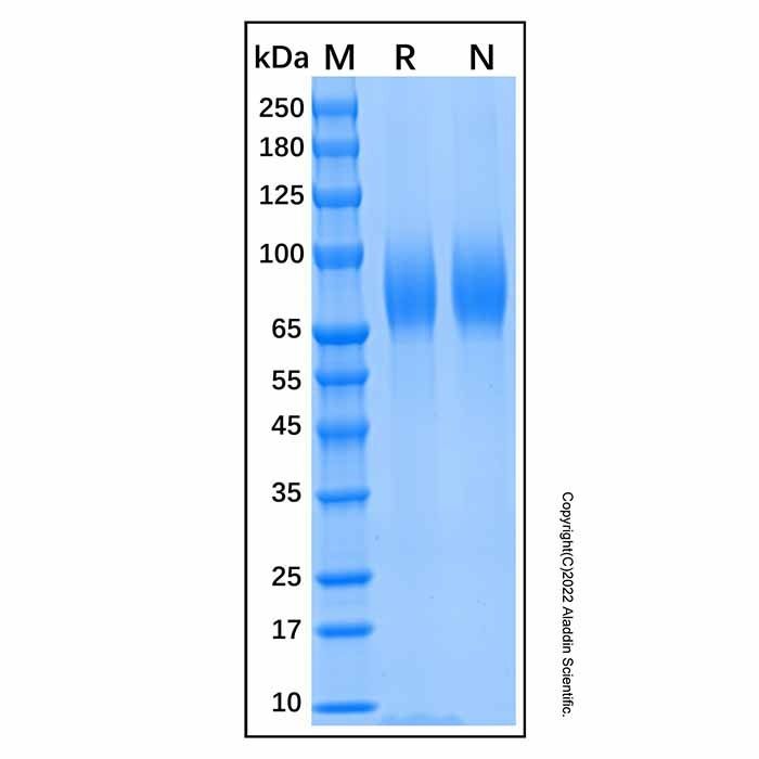 Recombinant Human Tau Protein -    by Aladdin Scientific