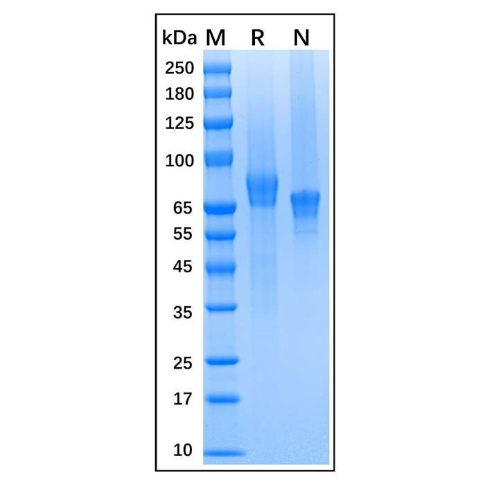 Recombinant Human Thrombomodulin/BDCA-3 Protein -    by Aladdin Scientific