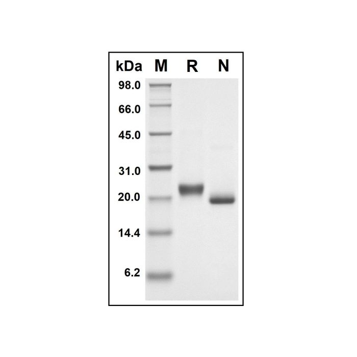 Recombinant Human TNFRSF1A Protein -    by Aladdin Scientific