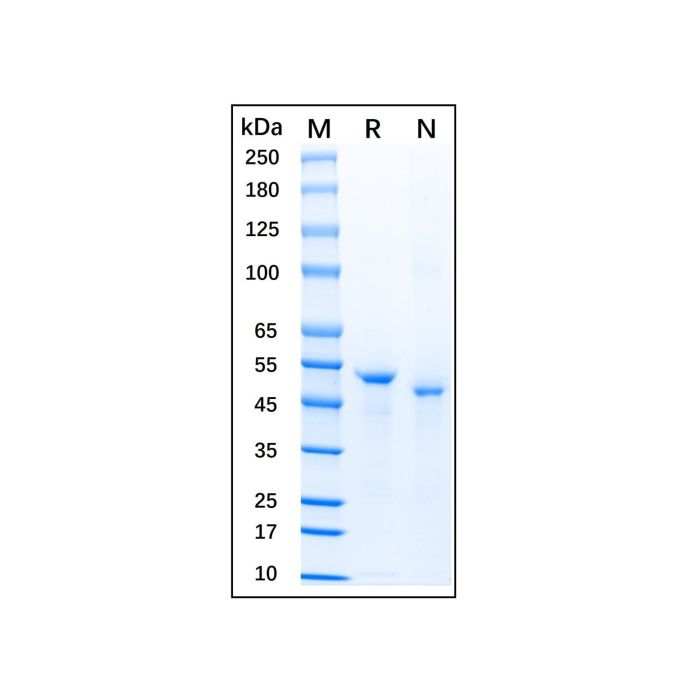 Recombinant Human TNF RII/TNFRSF1B Protein -    by Aladdin Scientific