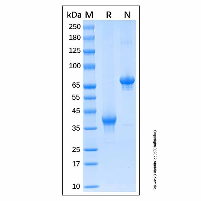 Recombinant Human TWEAK R/TNFRSF12 Protein -    by Aladdin Scientific