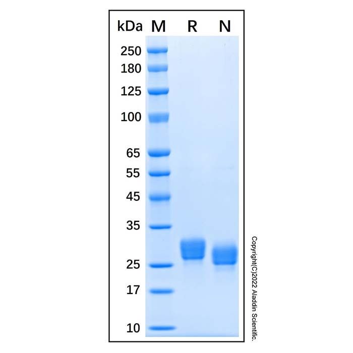 Recombinant Human ULBP-1 Protein -    by Aladdin Scientific