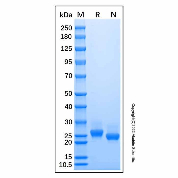 Recombinant Mouse Lipocalin-2/NGAL Protein -    by Aladdin Scientific
