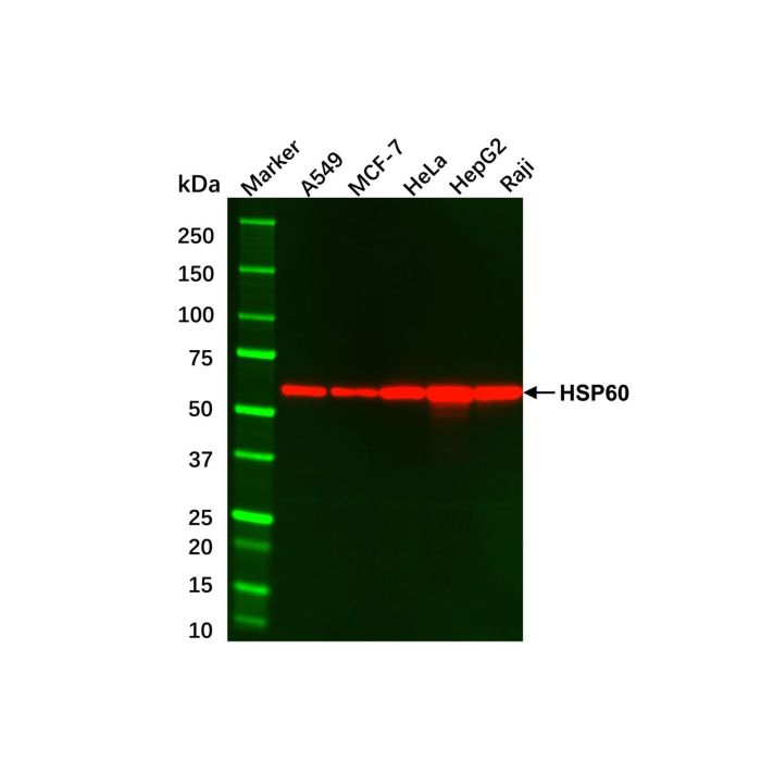 MCF7 Whole Cell Lysate -    by Aladdin Scientific