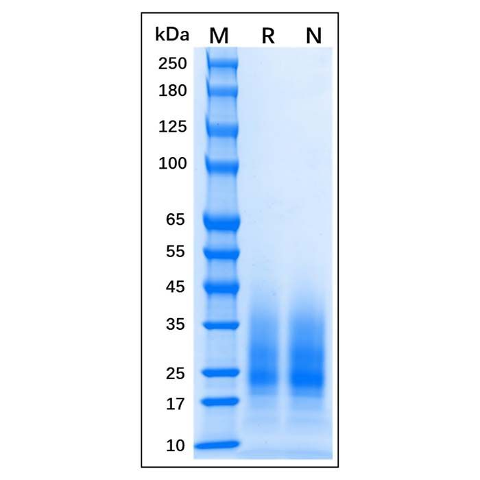 Recombinant MPXV M1R Protein -    by Aladdin Scientific