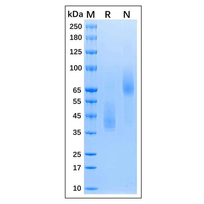 Recombinant MPXV E8L Protein -    by Aladdin Scientific