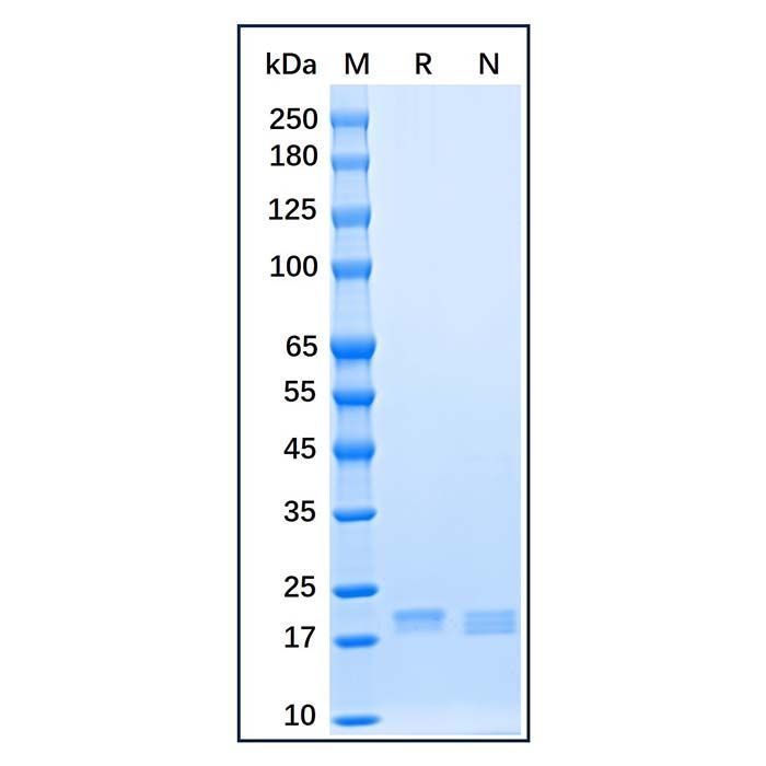 Recombinant Human Sonic Hedgehog Protein -    by Aladdin Scientific