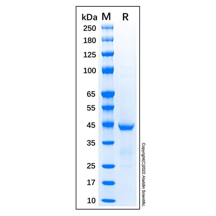 Recombinant Human ACTA2 Protein -    by Aladdin Scientific