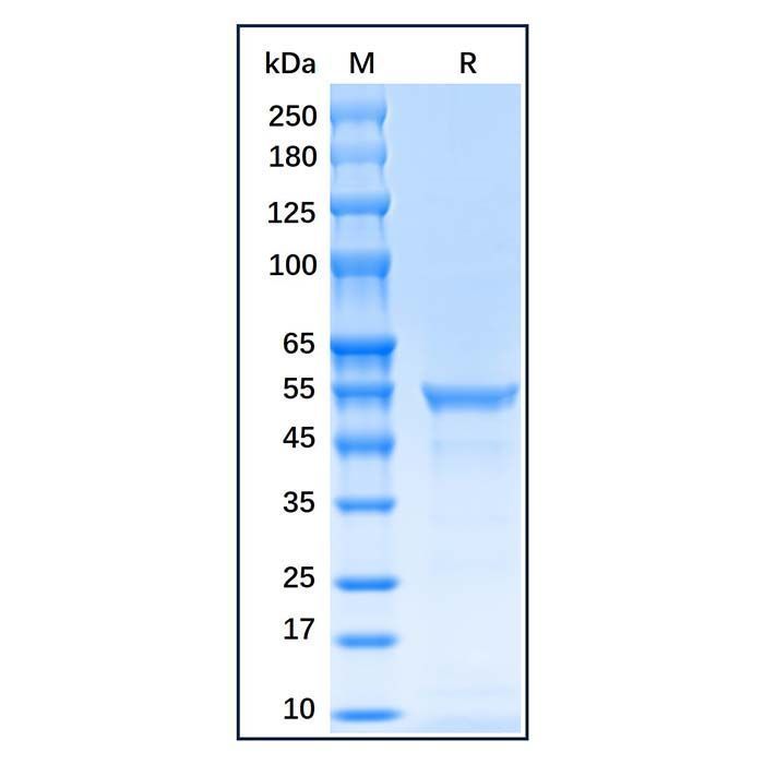 Recombinant Human Vimentin Protein -    by Aladdin Scientific