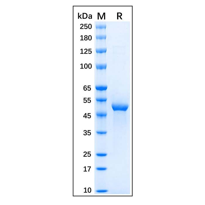 Recombinant Human GFAP Protein -    by Aladdin Scientific