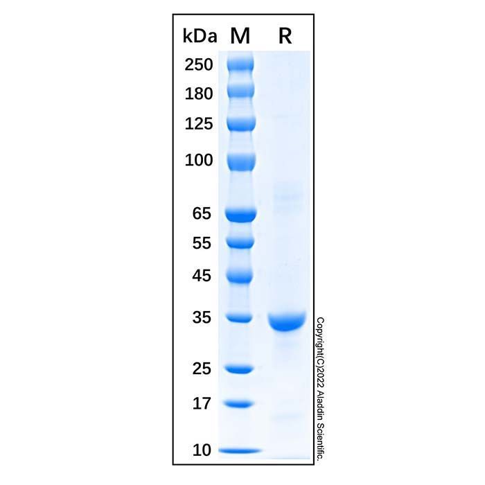 Recombinant Human Cyclin D1 Protein -    by Aladdin Scientific