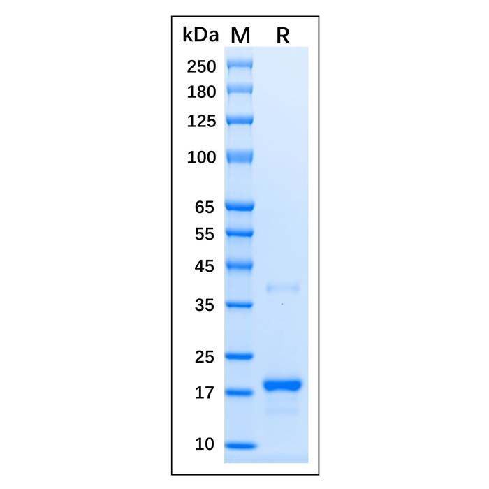 Recombinant Human p21 Protein -    by Aladdin Scientific