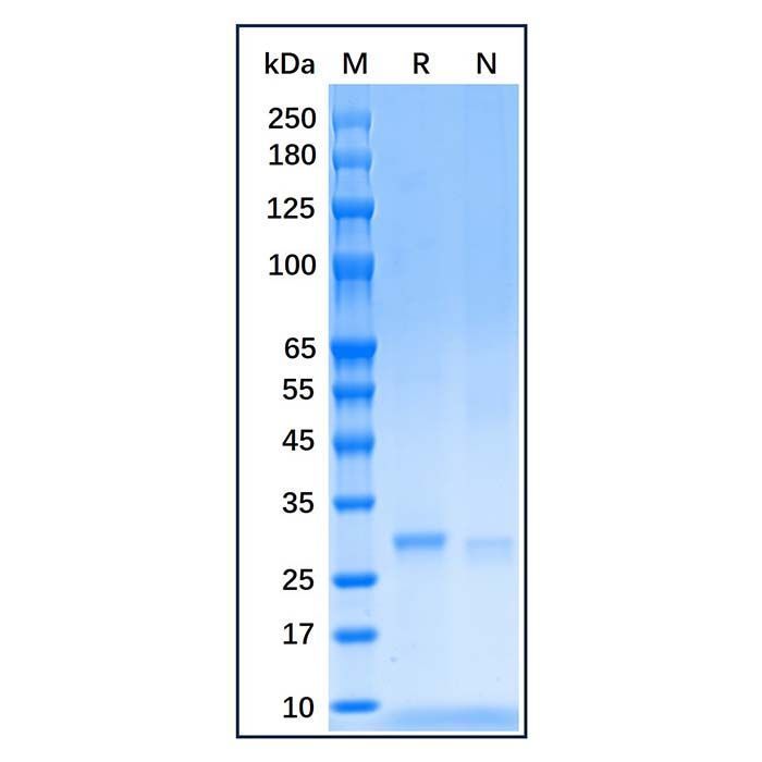 Recombinant Human SDHB Protein -    by Aladdin Scientific