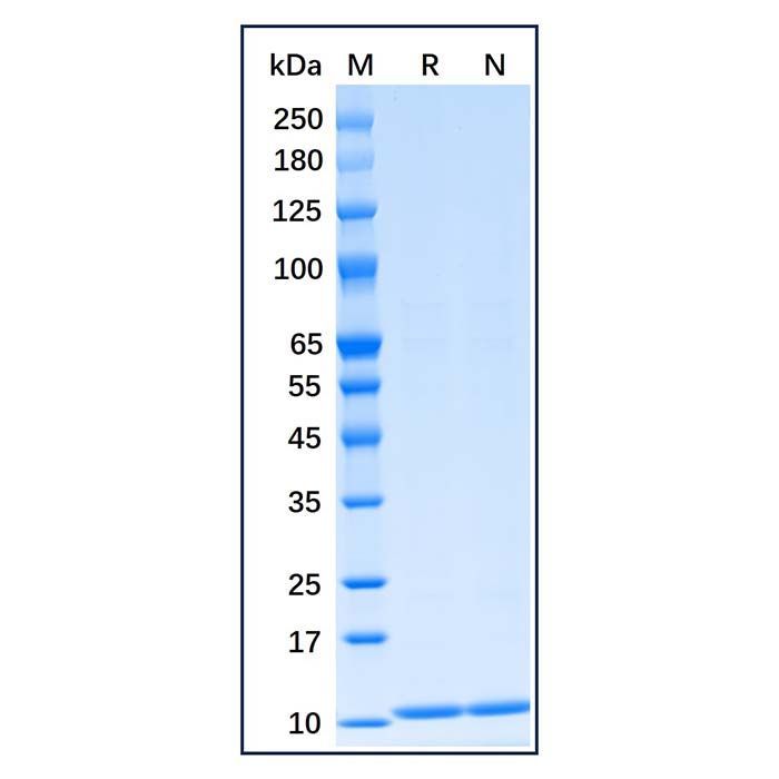 Recombinant Human S100B Protein -    by Aladdin Scientific