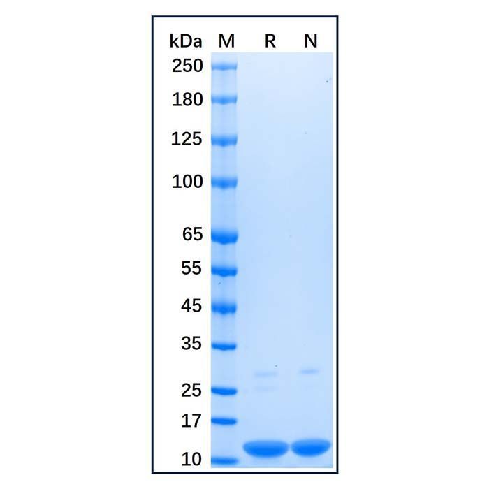 Recombinant Human Parvalbumin Protein -    by Aladdin Scientific