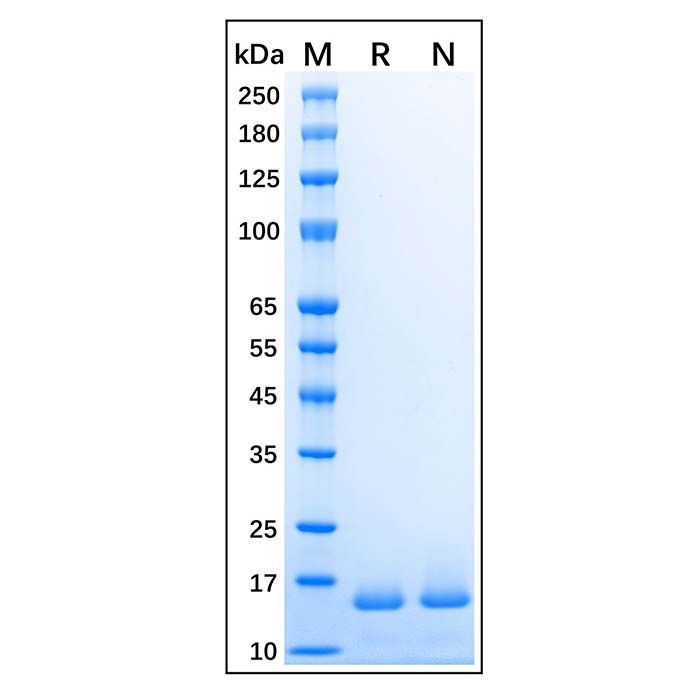 Recombinant Human Histone H2B Protein -    by Aladdin Scientific
