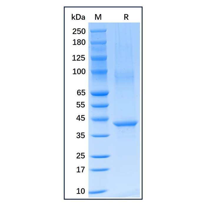 Recombinant Human Aurora B Protein -    by Aladdin Scientific