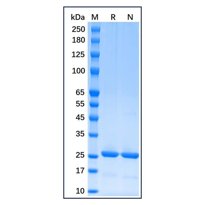 Recombinant Human Bcl-2 Protein -    by Aladdin Scientific