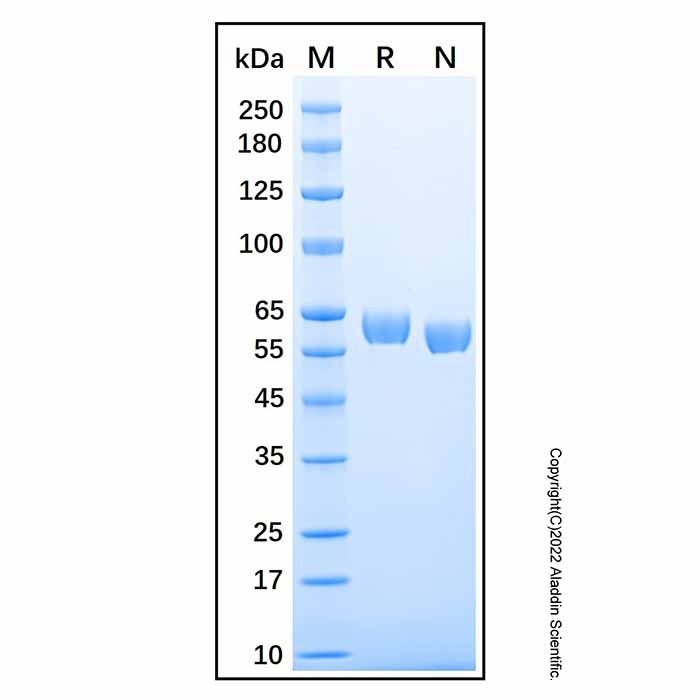Recombinant Human DPPII/QPP/DPP7 Protein -    by Aladdin Scientific