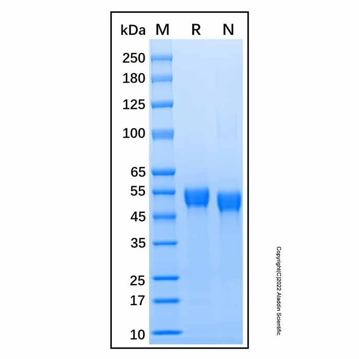 Recombinant Mouse Cathepsin C/DPPI Protein -    by Aladdin Scientific