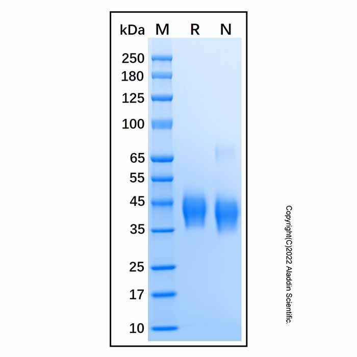 Recombinant Human BTN2A1/Butyrophilin 2A1 Protein -    by Aladdin Scientific