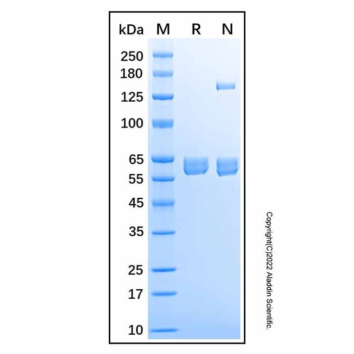 Recombinant Human Carboxylesterase 2/CES2 Protein -    by Aladdin Scientific