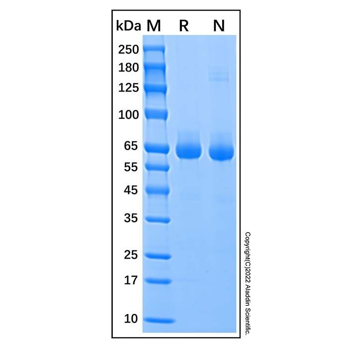 Recombinant Human Alkaline Phosphatase/ALPL Protein -    by Aladdin Scientific