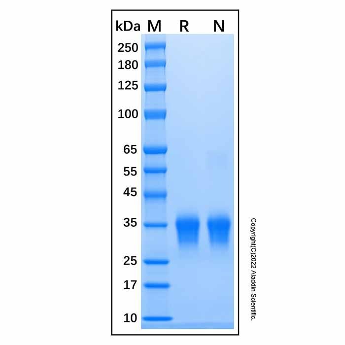 Recombinant Mouse IFN-beta Protein -    by Aladdin Scientific