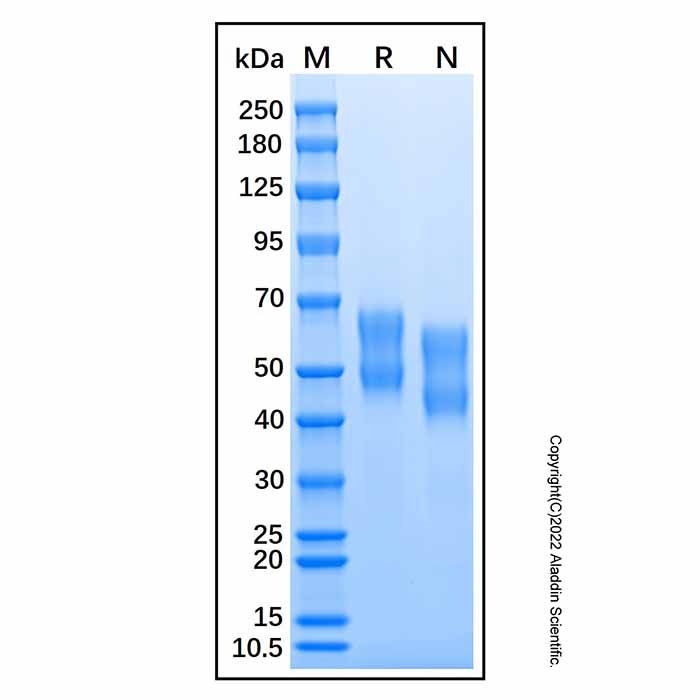 Recombinant Mouse IL-6R alpha Protein -    by Aladdin Scientific