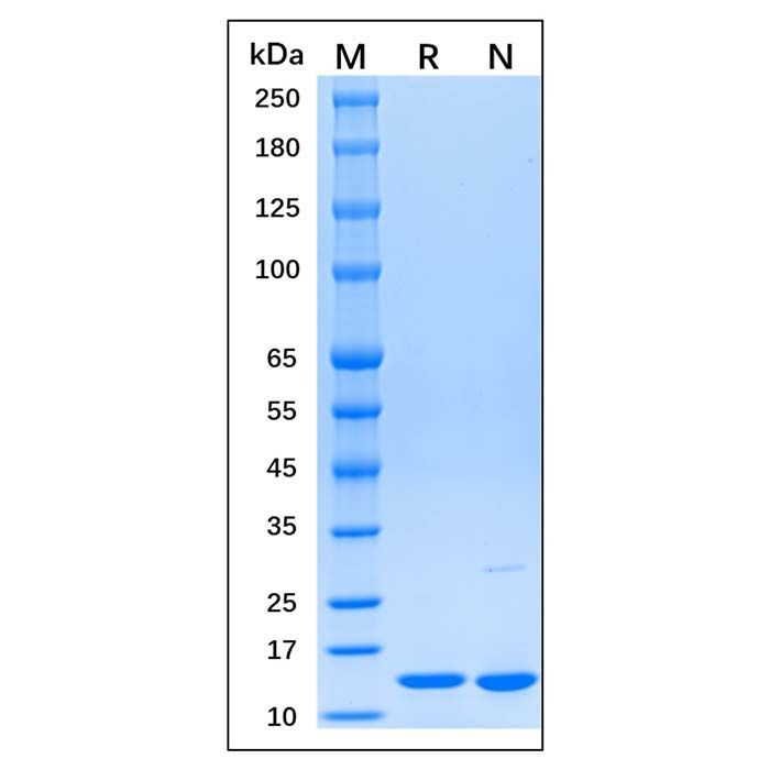 Recombinant Human β2-microglobulin Protein -    by Aladdin Scientific