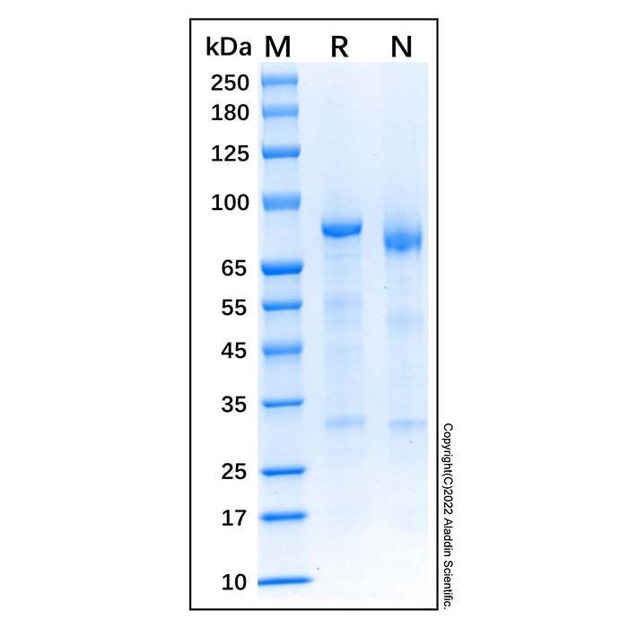 Recombinant Human Complement C1s Protein -    by Aladdin Scientific