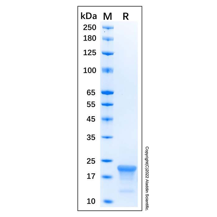 Recombinant Human CASP-1 Protein -    by Aladdin Scientific