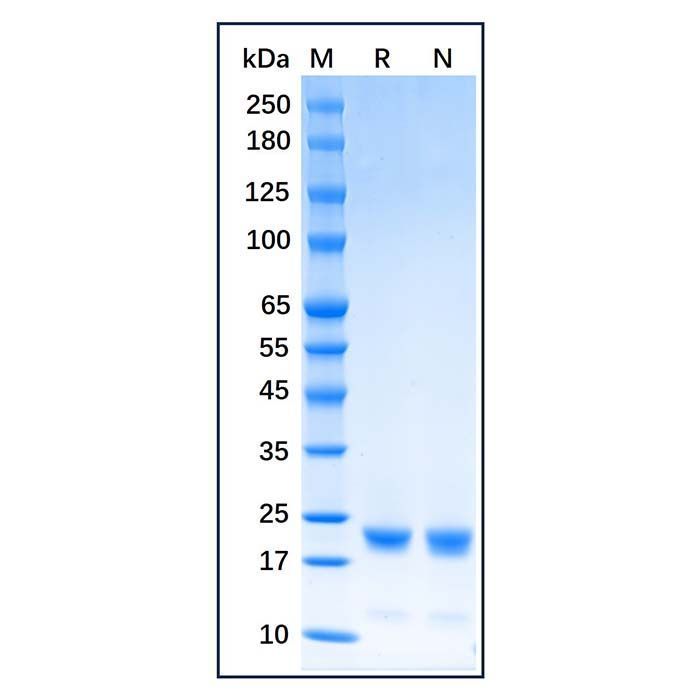 Recombinant Human Cofilin Protein -    by Aladdin Scientific