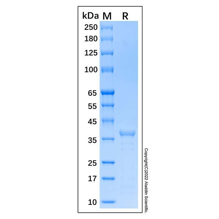 Recombinant Human mTOR Protein -    by Aladdin Scientific