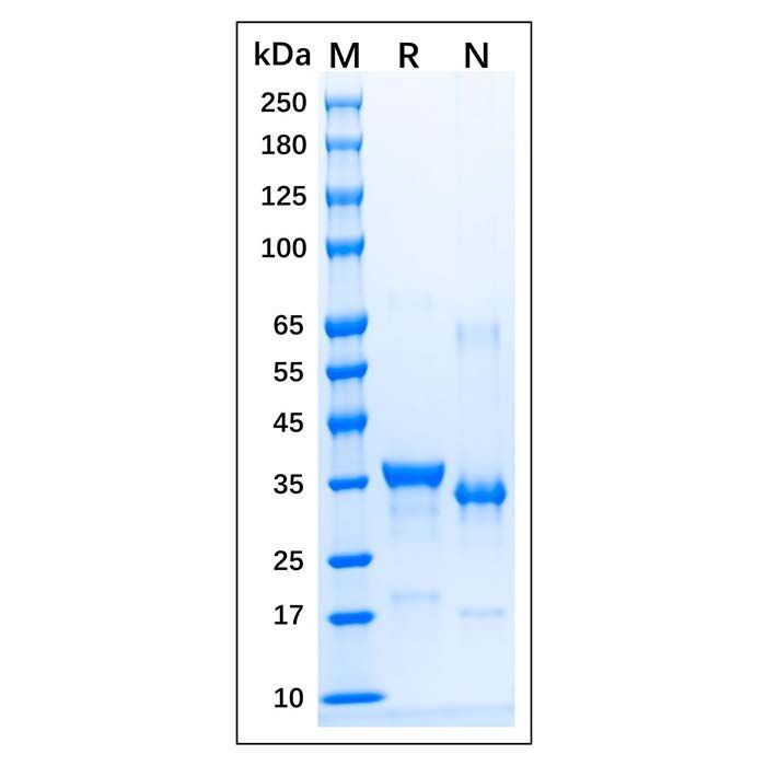 Recombinant Human iNOS Protein -    by Aladdin Scientific