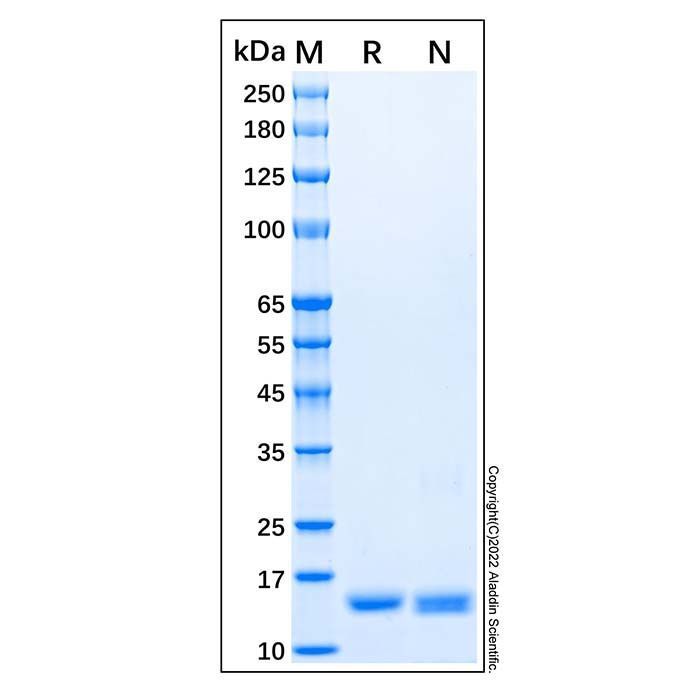 Recombinant Human IL-36Ra/IL-1F5 Protein -    by Aladdin Scientific