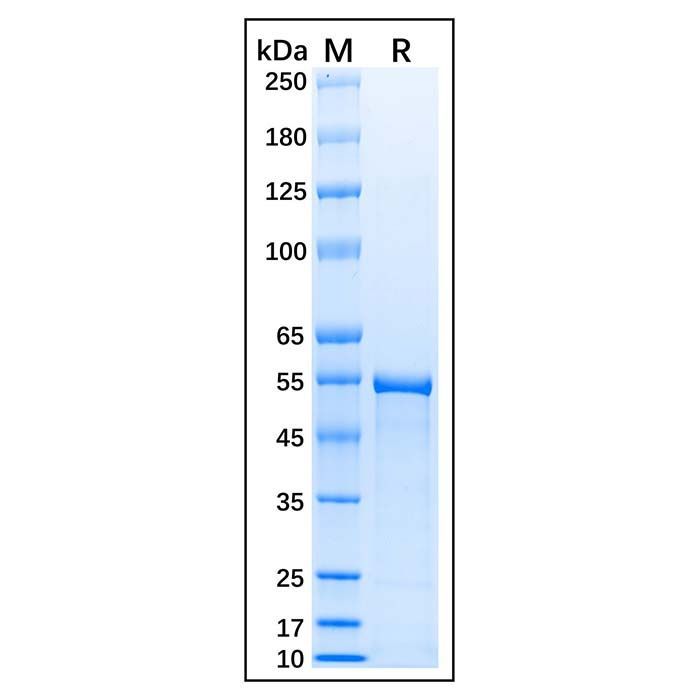 Recombinant Human alpha Tubulin Protein -    by Aladdin Scientific