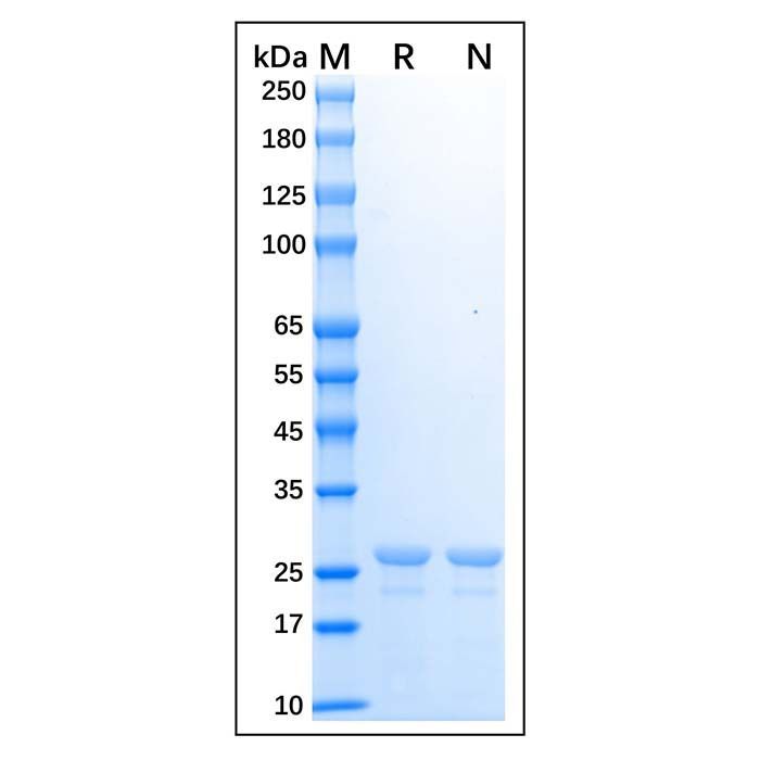 Recombinant Human HLA-DRA Protein -    by Aladdin Scientific